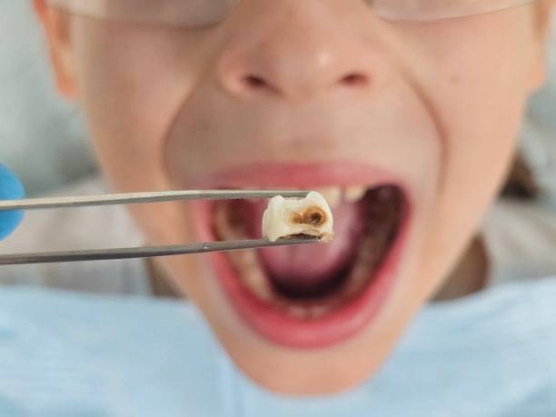 Best Walk-In Emergency Dentist in Heritage Lake, IN